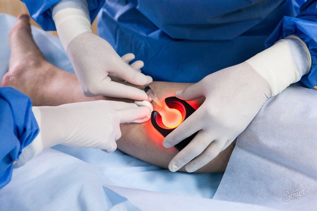Varikoos vénák a lábak diagnosztikáján