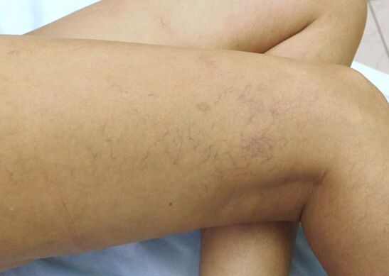 Érrendszeri csillagok