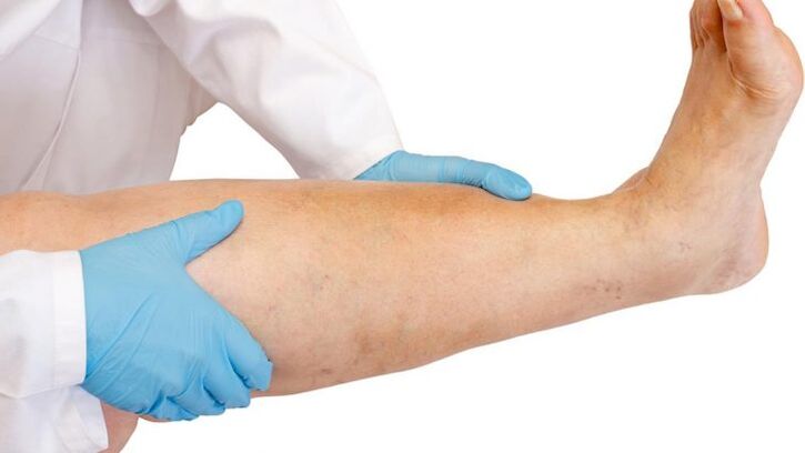 hogyan lehet azonosítani a betegséget